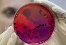 Шестеро детей в возрасте от одного года до 13 лет госпитализированы в Узынсу Шестеро детей в возрасте от одного года до 13 лет госпитализированы в Узынсу