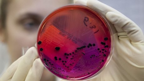 Шестеро детей в возрасте от одного года до 13 лет госпитализированы в Узынсу Шестеро детей в возрасте от одного года до 13 лет госпитализированы в Узынсу