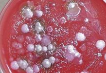 Главный ветеринарный-санитарный врач области: В Прииртышье сибирская язва не выявлена Главный ветеринарный-санитарный врач области: В Прииртышье сибирская язва не выявлена