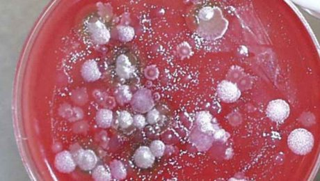 Главный ветеринарный-санитарный врач области: В Прииртышье сибирская язва не выявлена Главный ветеринарный-санитарный врач области: В Прииртышье сибирская язва не выявлена