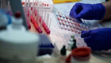 В Казахстане за последний месяц зарегистрировано 16 случаев заболевания сибирской язвой В Казахстане за последний месяц зарегистрировано 16 случаев заболевания сибирской язвой