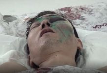 Медики рассказали о состоянии упавшего в шахту лифта шымкентца Медики рассказали о состоянии упавшего в шахту лифта шымкентца