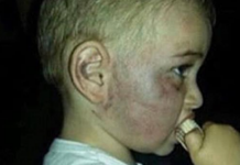 Жители Тараза возмущены решением по делу об избиении ребёнка в детсаду Жители Тараза возмущены решением по делу об избиении ребёнка в детсаду