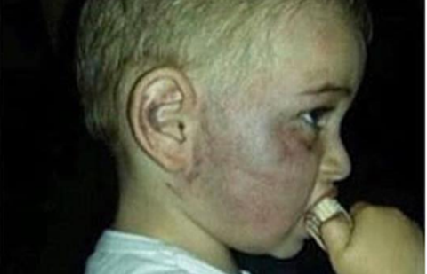 Жители Тараза возмущены решением по делу об избиении ребёнка в детсаду Жители Тараза возмущены решением по делу об избиении ребёнка в детсаду